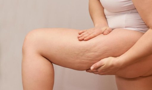 What is cellulite? What products are recommended to use against cellulite?