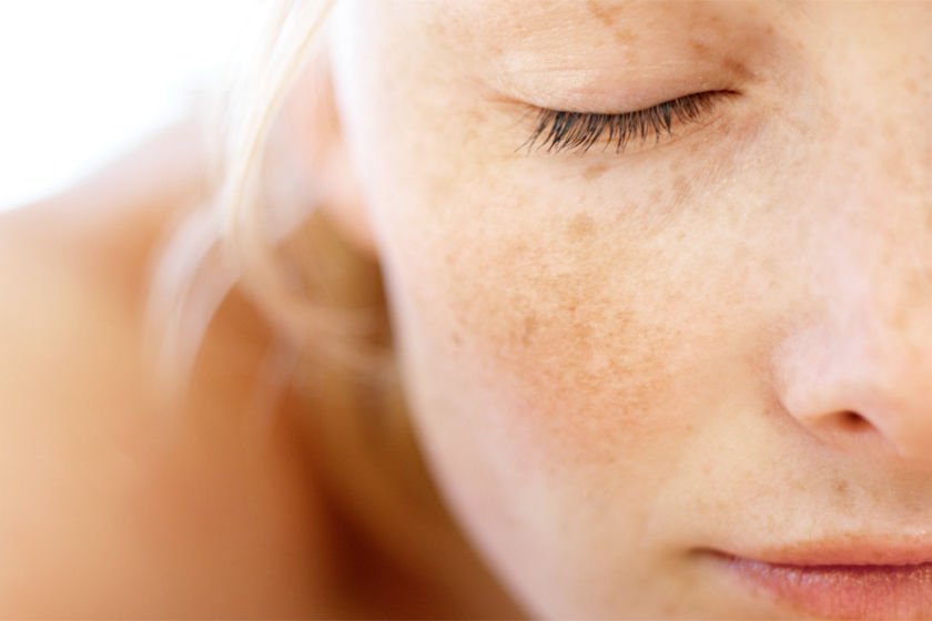 What is lactic acid? What are its effects on the skin?