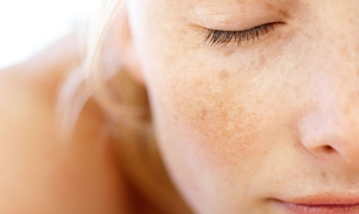 What is lactic acid? What are its effects on the skin?