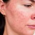 Don't Do These If You Have Sensitive Skin - Care Tips  for sensitive skin